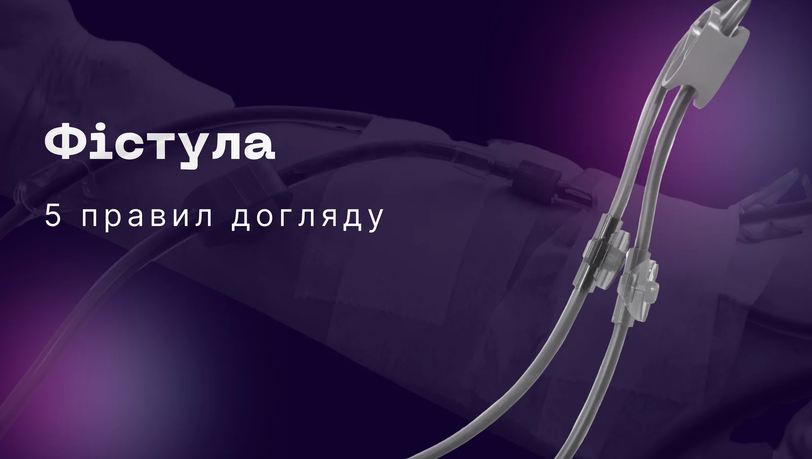 Фістула. 5 правил догляду