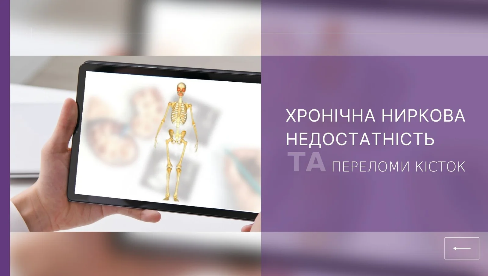 ХХН та переломи кісток