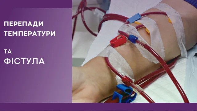 Як впливають перепади температури на фістулу