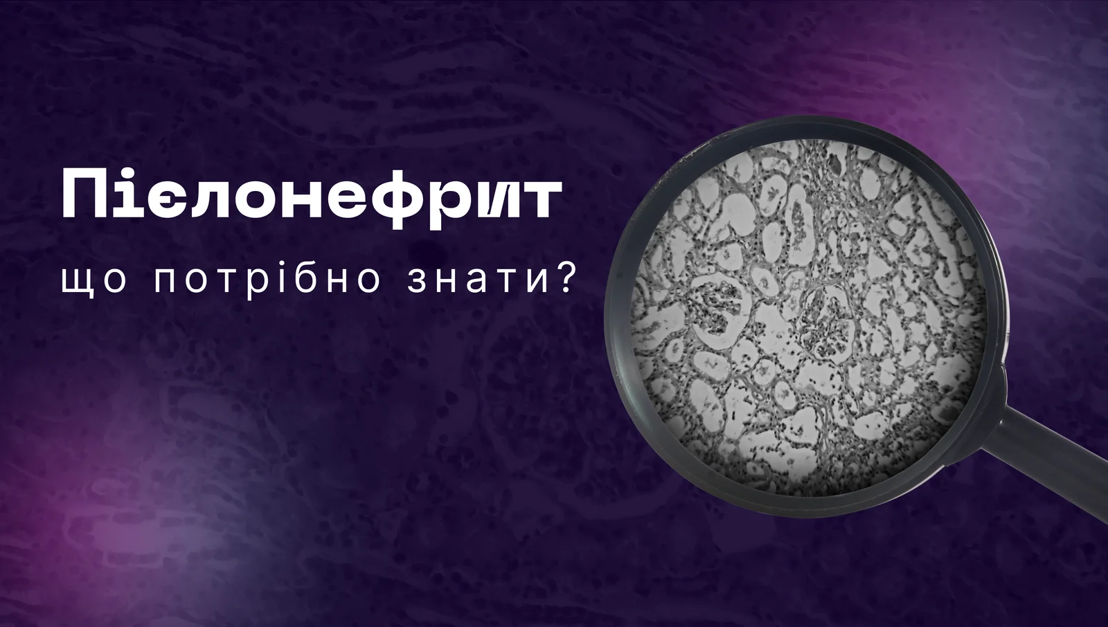 Що потрібно знати про пієлонефрит?