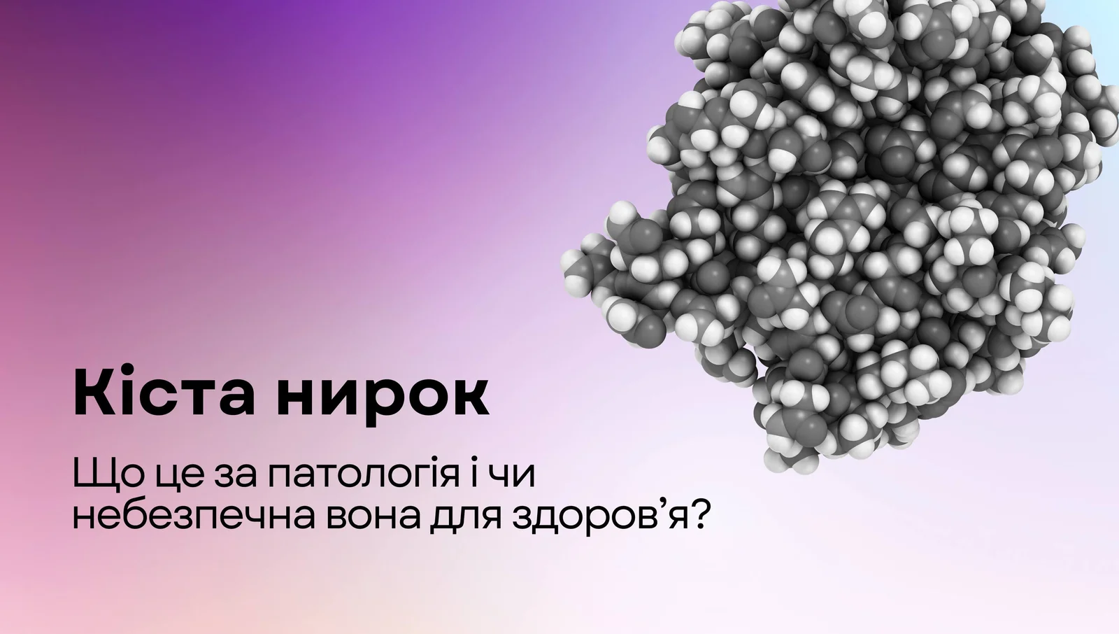 Кіста нирок
