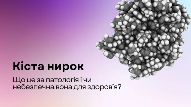 Кіста нирок