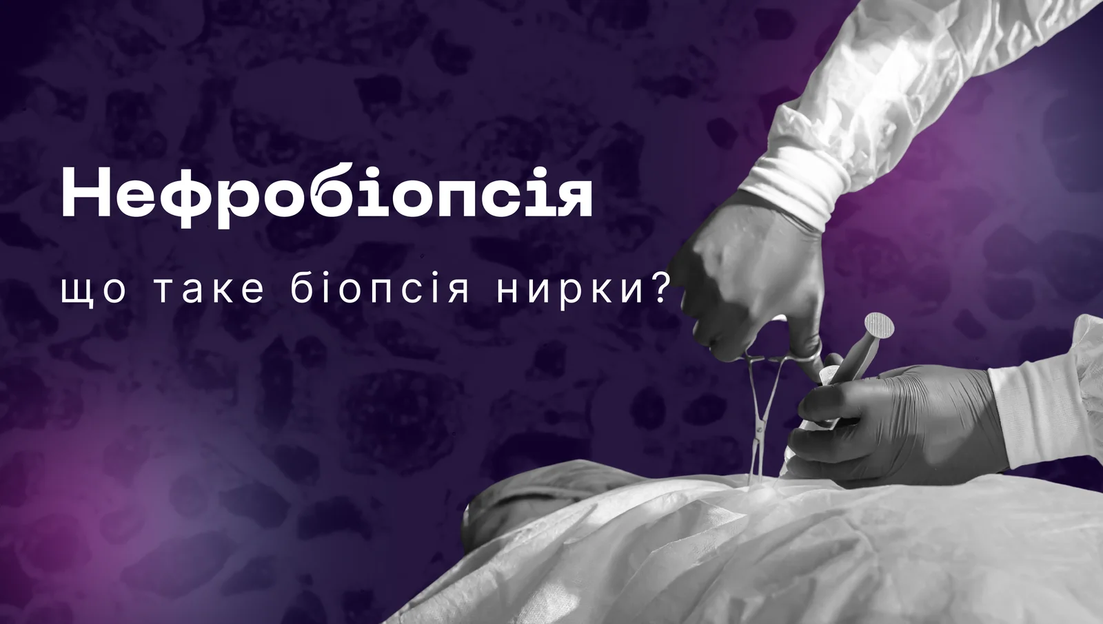 НЕФРОБІОПСІЯ- Що таке біопсія нирки?
