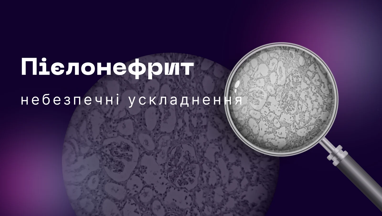 Пієлонефрит
