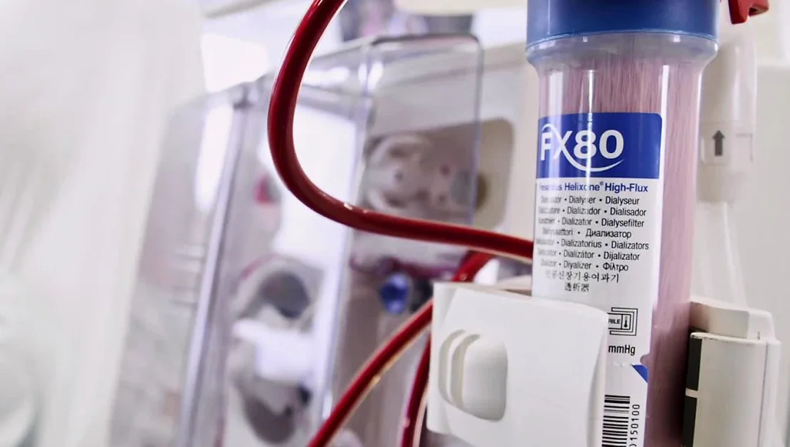 fb_Dialysator_FX80.jpg