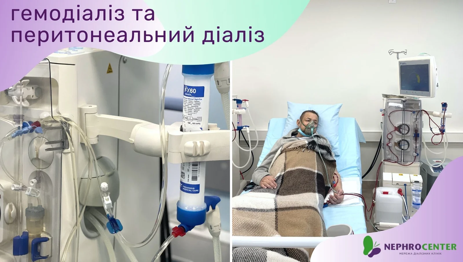 гемодіаліз та перитонеальний діаліз.jpg