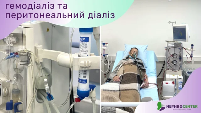 гемодіаліз та перитонеальний діаліз.jpg