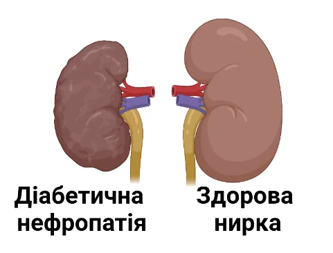 укр 1.png